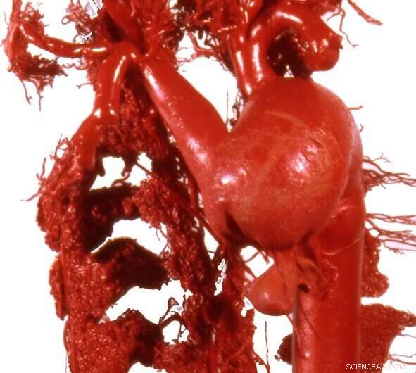 How Whale Brains Avoid Damage While Swimming