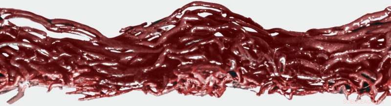 How Whale Brains Avoid Damage While Swimming