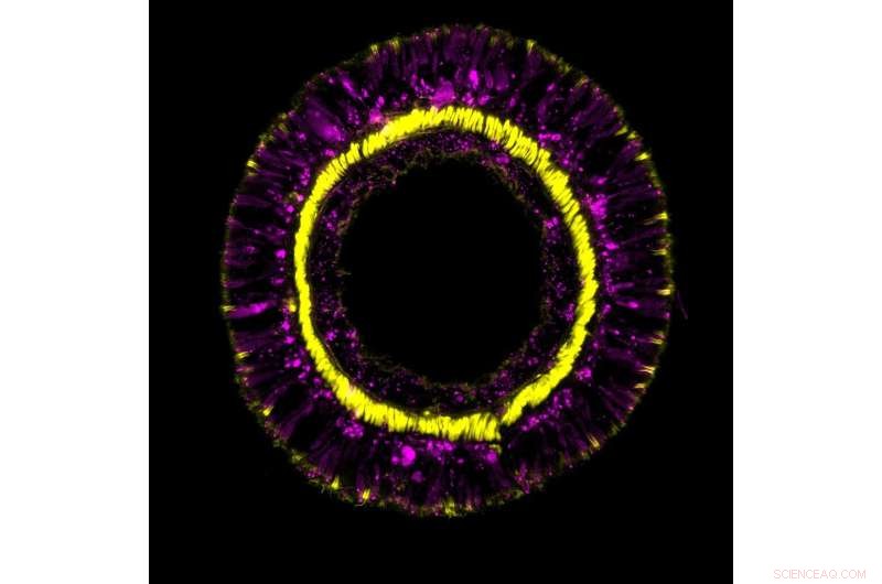 Ancient Gene Pathways Preserve Youth in Sea Anemones