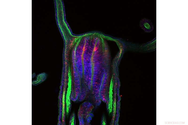 Ancient Gene Pathways Preserve Youth in Sea Anemones