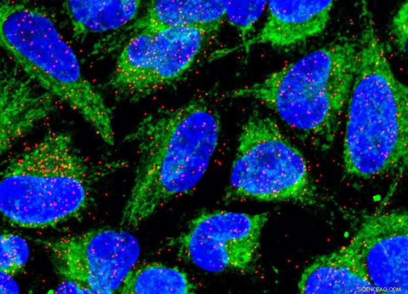 Scientists Reveal How the Immune System s Alarm is Silenced