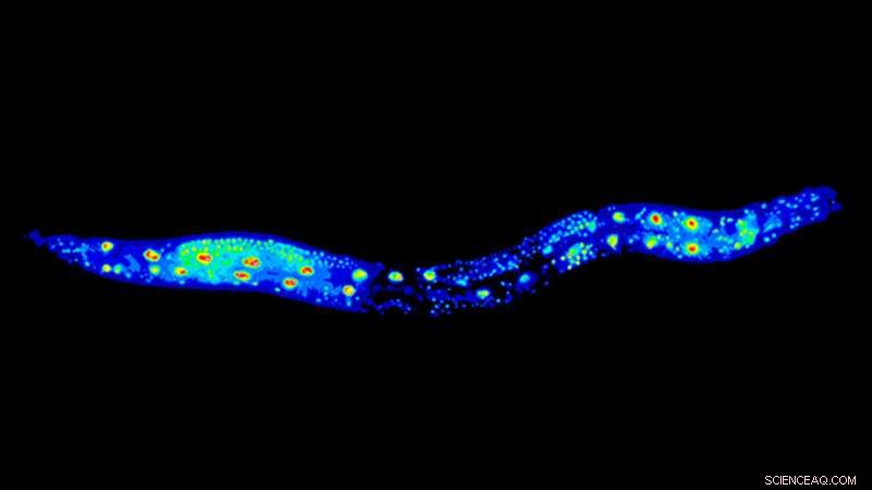 Longer Lifespan in Worms Linked to Disrupted RNA Processing, New Study Reveals