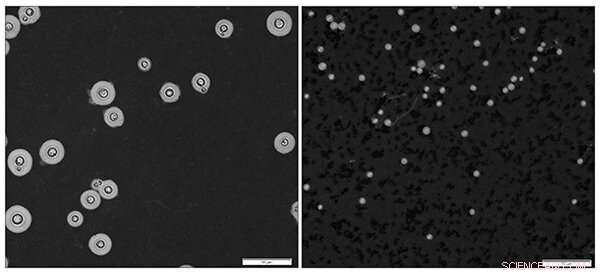 New Study Reveals Shrinking Fungus Boosts Brain Infection