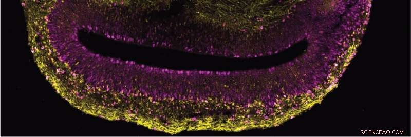 Brain Organoids Reveal Key Insights into Human Brain Evolution