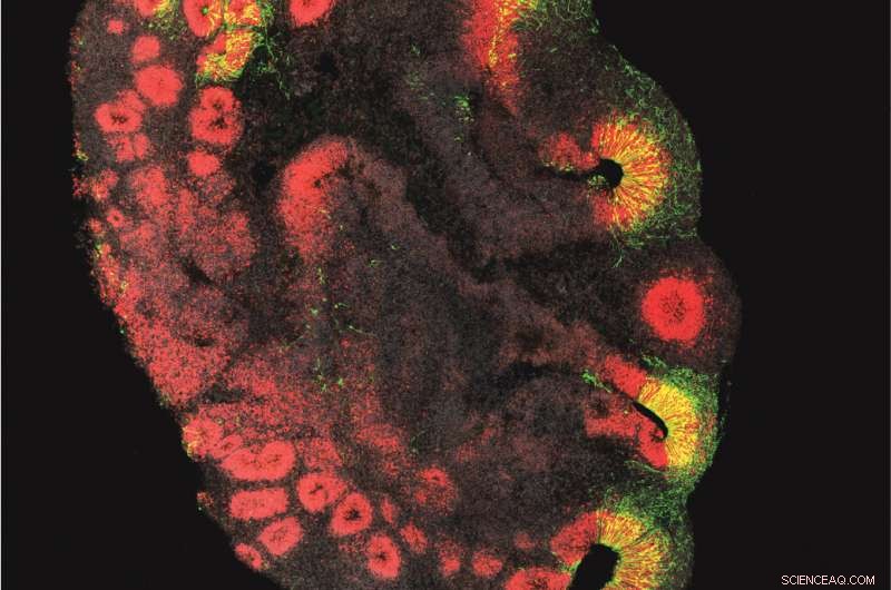 Brain Organoids Reveal Key Insights into Human Brain Evolution