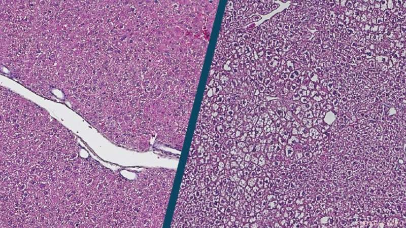 Unlocking Liver Fitness: A Key Building Block for Healthy Aging