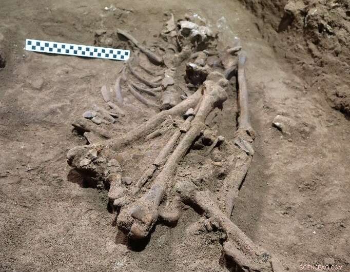 31,000‑Year‑Old Borneo Skeleton Reveals Successful Ancient Amputation Surgery