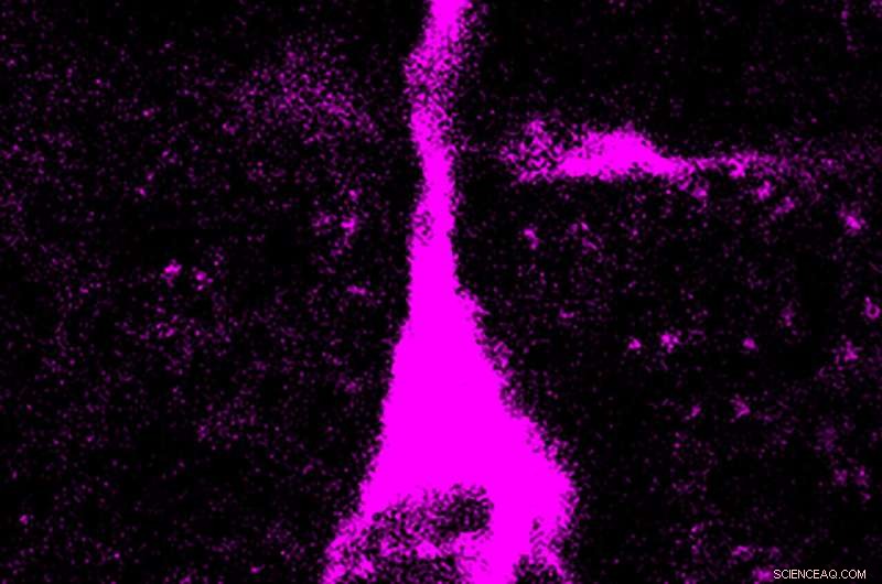 Modern Humans Produce More Brain Neurons Than Neandertals, New Study Finds