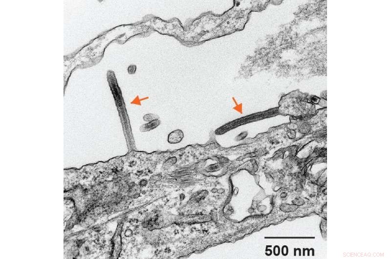 Stem-Cell Derived Liver Cells Offer Fresh Insights into Ebola Infection