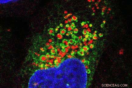 Pitt Scientists Uncover Pathway to Repair Longevity-Boosting Lysosomes
