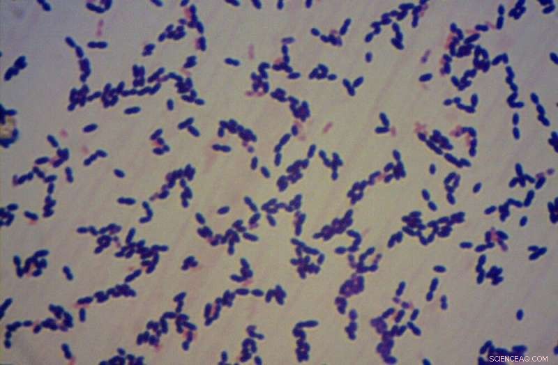 New Method Detects Antibiotic Resistance in Meningitis-Causing Bacteria
