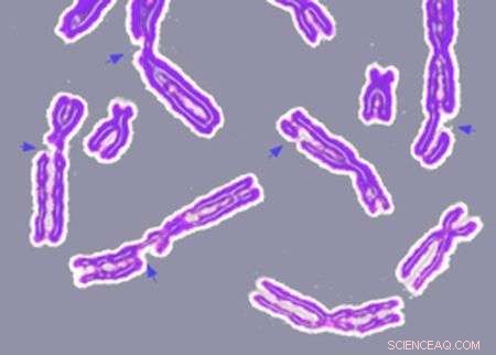 Chromatin Dynamics Drive DNA Repair: Insights for Cancer Diagnosis and Therapy