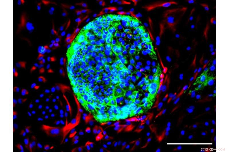 Scientists Engineer Novel Human Cell Type to Advance Stem Cell Research