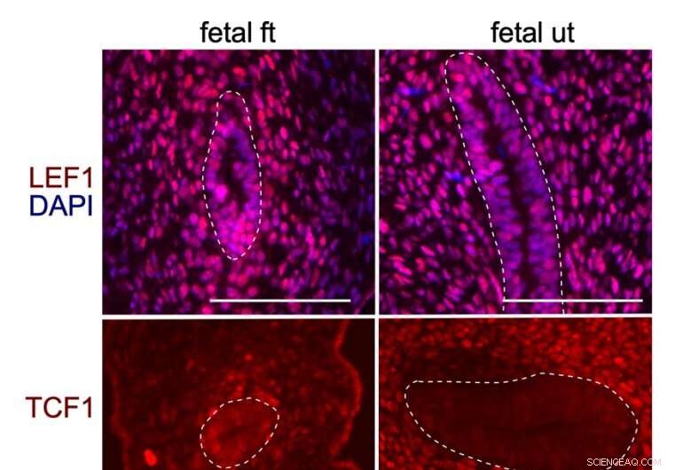 Groundbreaking Technique Enables Culturing of Human Fetal Fallopian Tube and Uterine Tissue for Reproductive Reconstruction