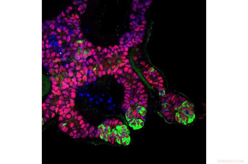 Lab-Generated Human Kidneys: A Major Step Toward Treating Kidney Disease