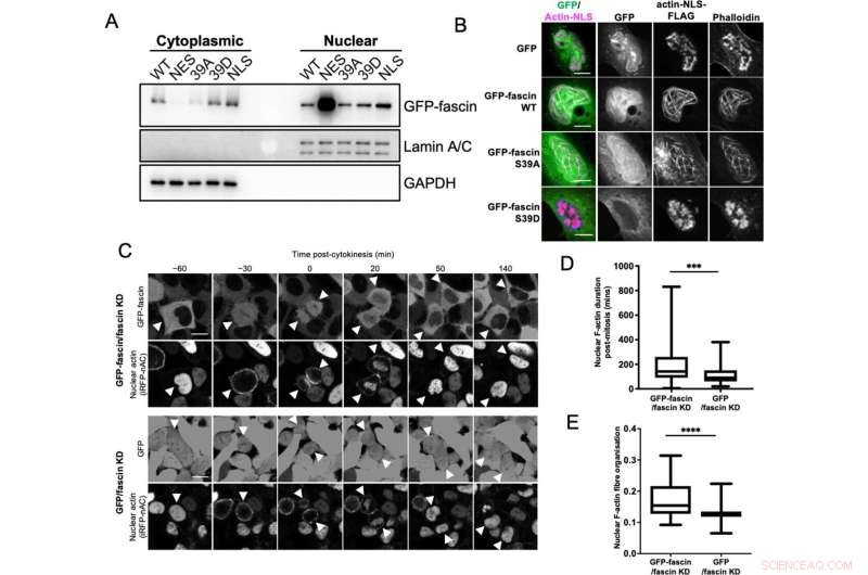 Scientists Discover Promising Target That May Stop Cancer Metastasis