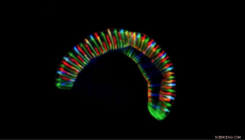 Scientists Uncover Caterpillar‑Like Bacteria Thriving Inside Human Mouths