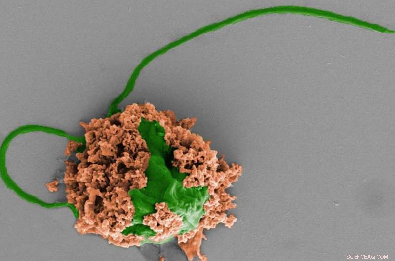Microrobots Swim to Treat Fatal Pneumonia in Mice