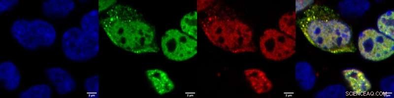 In-Silico Protein Probes for Early Detection of Neurodegenerative Diseases