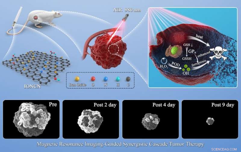 Near‑Infrared‑Activated Nanozyme Enables Synergistic Cascade Tumor Therapy with Real‑Time MRI Guidance