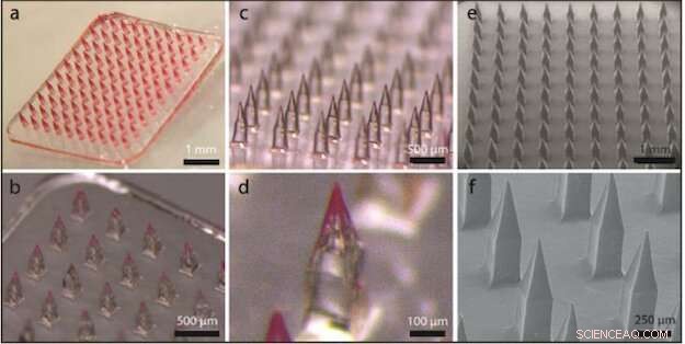 Microneedles Unlock Curcumin’s Full Therapeutic Potential