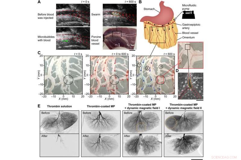 Microrobots Swarms for Targeted Medical Embolization: Enhancing Junction Integrity