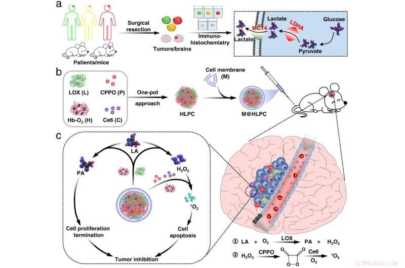 Breakthrough Biomimetic Therapy Offers New Hope for Glioblastoma Patients