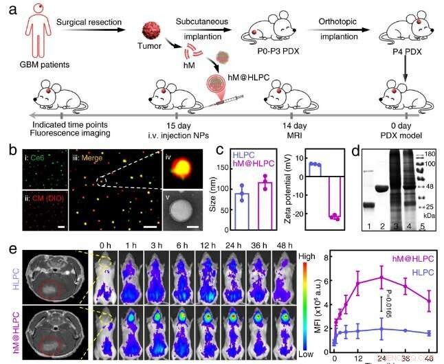 Breakthrough Biomimetic Therapy Offers New Hope for Glioblastoma Patients