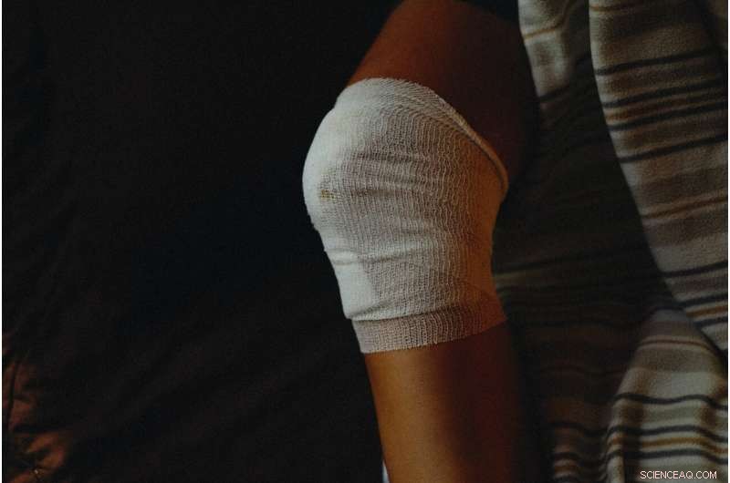 Tissue Nanotransfection: A Non‑Viral Topical Gene‑Editing Solution for Healing Complex Skin Wounds