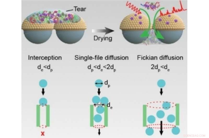 Revolutionary Tear-Based Test Detects Jaundice with Unmatched Accuracy