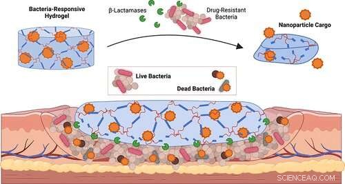 Targeted Drug Delivery: System Releases Therapeutics Only in Presence of Bacteria