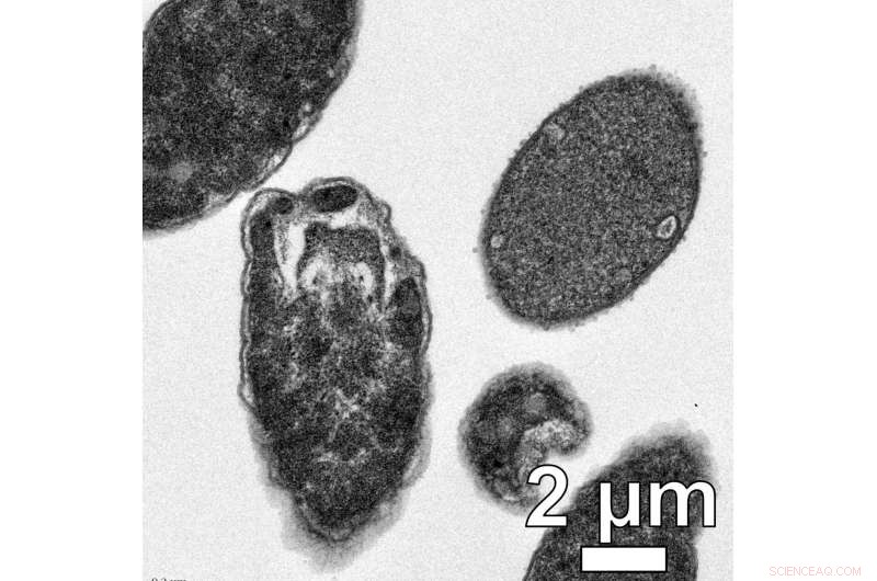 Light-Activated Nano-Drills: Advanced Molecular Machines Combat Antibiotic-Resistant Bacteria