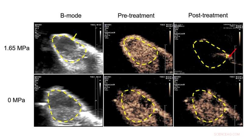 Sidekick Microbubbles Deliver Anti-Cancer Drugs and Disrupt Tumor Vasculature