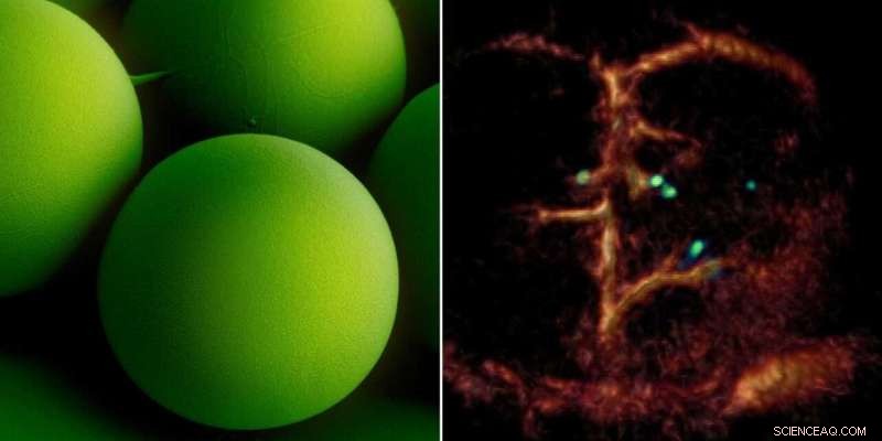 Optoacoustic Imaging Uncovers Microrobots Inside Living Organisms