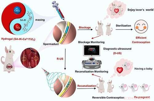 Reversible Hydrogel Male Contraceptive: Safe, Effective, and Easy to Remove