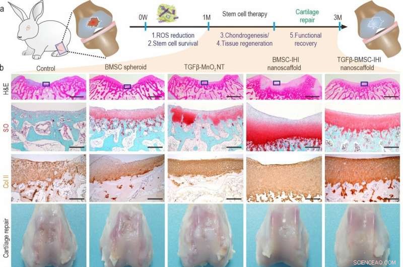 Injectable Stem Cell Scaffold for Enhanced Cartilage Regeneration