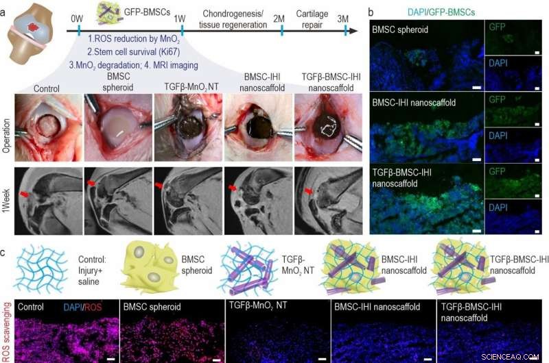 Injectable Stem Cell Scaffold for Enhanced Cartilage Regeneration