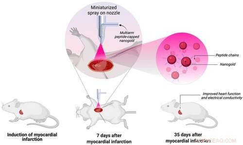 Tiny Gold Particle Spray Shows Promise for Heart Disease Treatment, Study Finds
