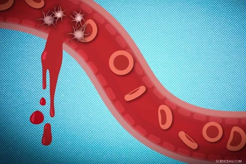 Optimizing Nanoparticle Size for Rapid Hemostasis in Traumatic Injuries