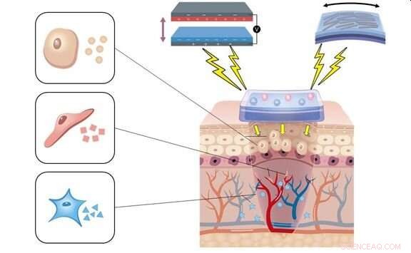 Micro‑Electric Generators Speed Up Wound Healing
