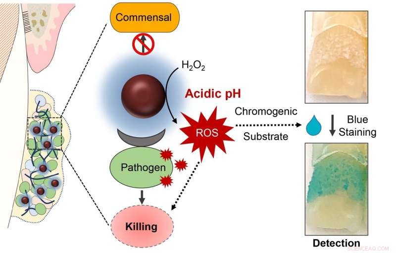 Nanozyme Therapy Eliminates Dental Plaque and Targets Harmful Oral Bacteria