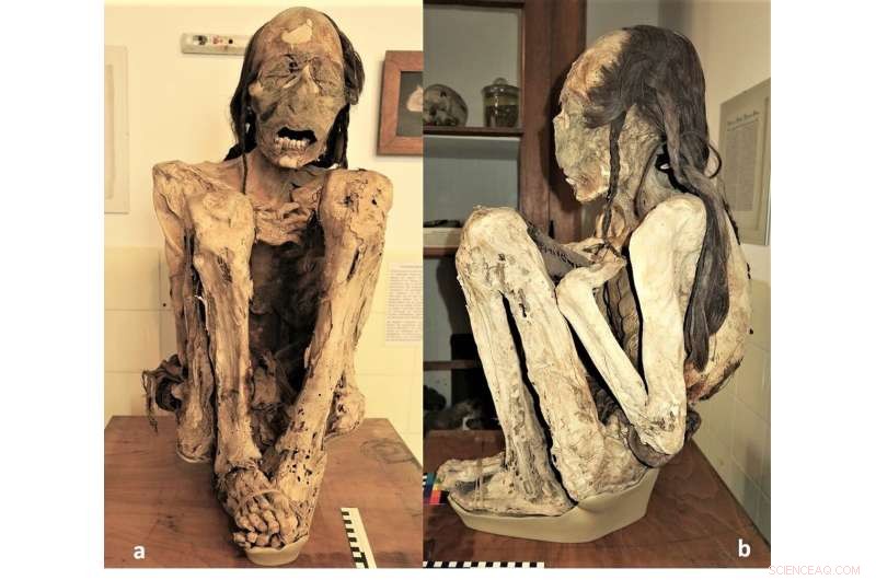 Forensic Analysis of South American Mummies Confirms Brutal Murders