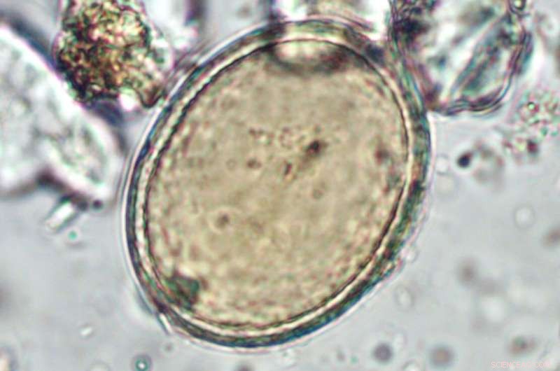 New Study Reveals Higher Parasite Rates Among Medieval Cambridge Friars