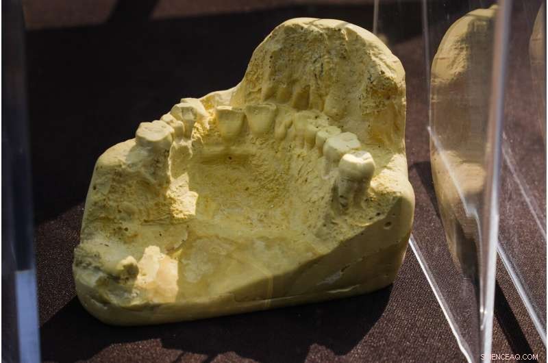 12 Hessian Soldiers  Remains Unearthed at Revolutionary War Battle Site