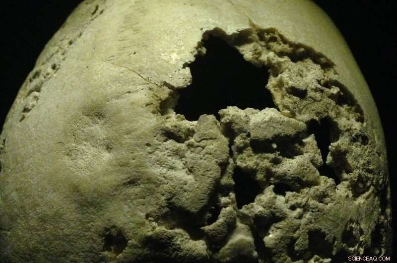 Historical Evidence Shows Syphilis Pre‑dated European Exploration, Supported by Manuscripts and Art