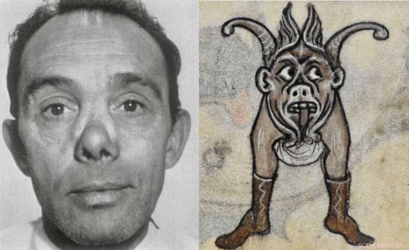 Historical Evidence Shows Syphilis Pre‑dated European Exploration, Supported by Manuscripts and Art