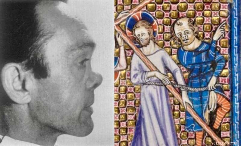 Historical Evidence Shows Syphilis Pre‑dated European Exploration, Supported by Manuscripts and Art