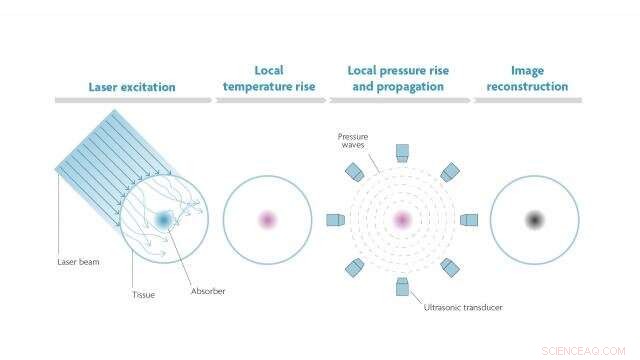 Photoacoustic Imaging: Advanced Light-Based Diagnostics for Medicine