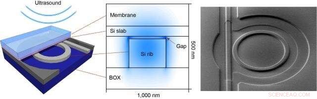 Photoacoustic Imaging: Advanced Light-Based Diagnostics for Medicine