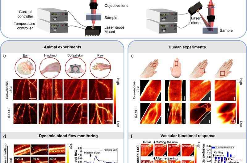 Enhanced Blood Flow Imaging: Transmissive Laser Speckle Contrast for Thick Tissue Monitoring